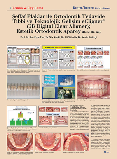 Zerrin Tüfekçi - Şeffaf Plaklar İle Ortodontik Tedavide Tıbbi ve Teknolojik Gelişim